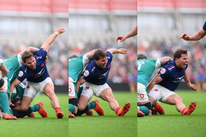 Blessure de dupont